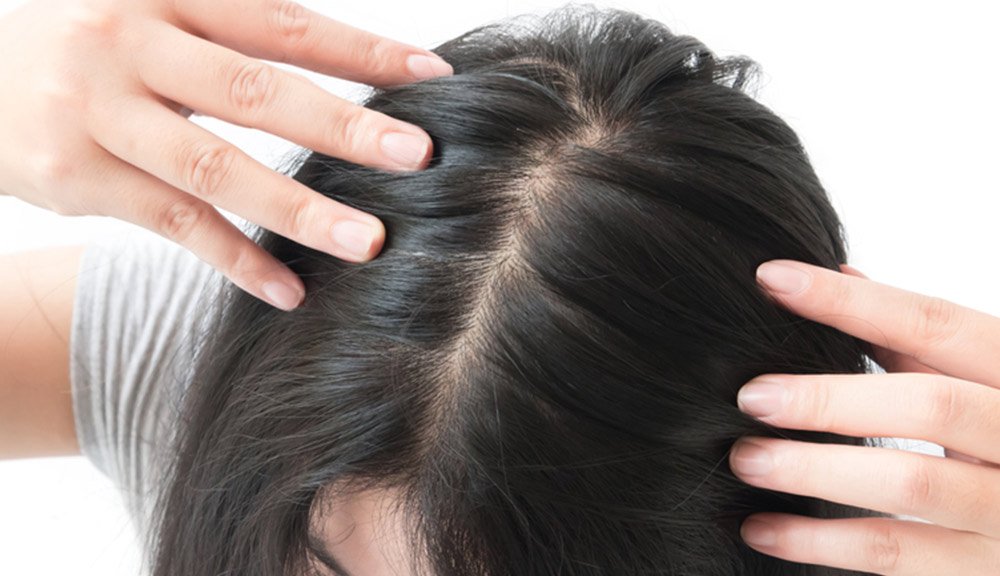 growth-of-lice-on-your-hair