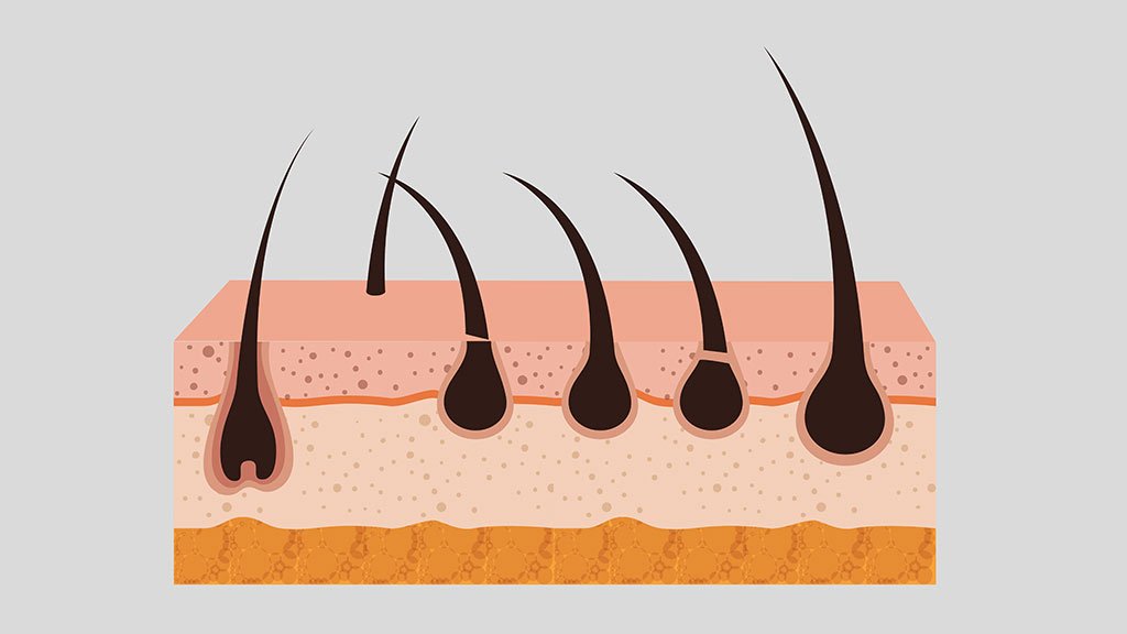 Limits-the-growth-of-ingrown-hair