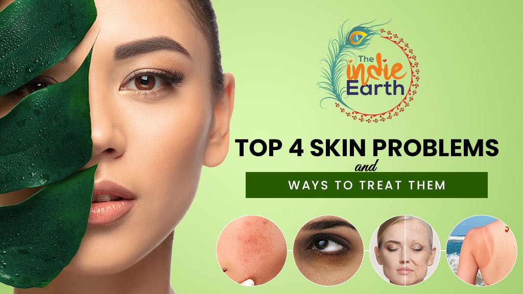 Top-4-skin-problems-and-how-to-treat-them